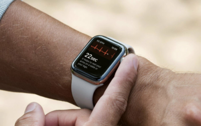 Comment faire un électrocardiogramme (ECG) sur l’Apple Watch ?
